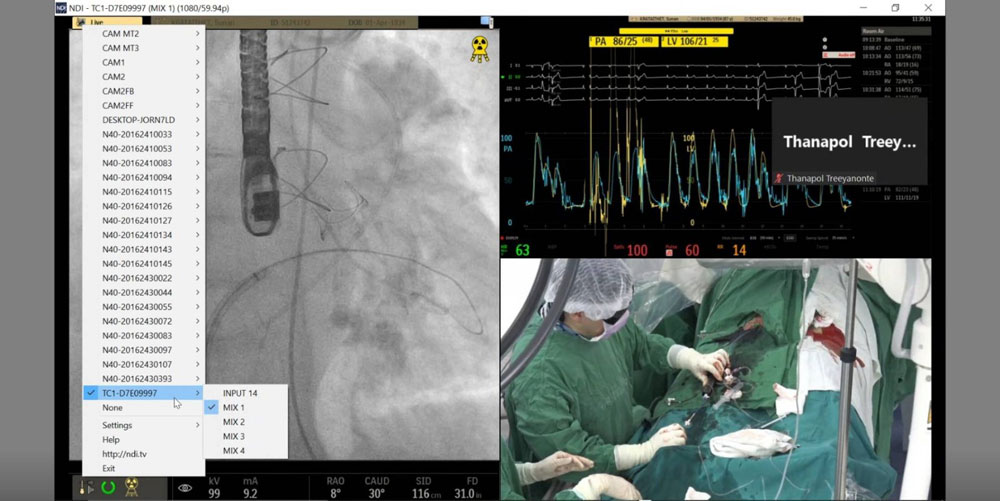 kiloview-case-center-medical-monitoring-system-by-her-majesty-cardiac-3